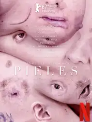 Skins